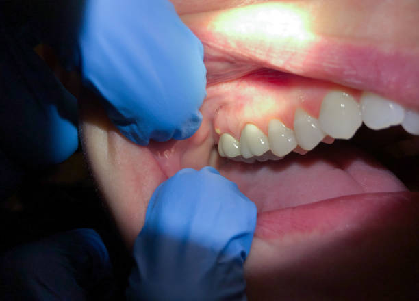 Best Walk-In Emergency Dentist in Marshall, WI